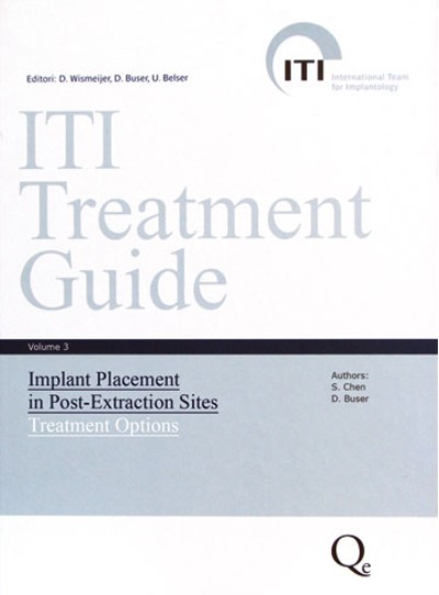 Guida al Trattamento ITI. Volume 3